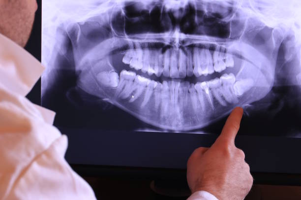Best Emergency Dental Care for Broken or Chipped Teeth in Vaiden, MS