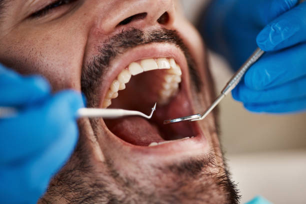 Best Emergency Treatment for Dental Infections or Abscesses in Vaiden, MS